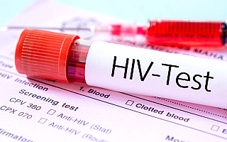 Rusza akcja anonimowych testów na HIV. „Mamy wiele doskonałych leków”